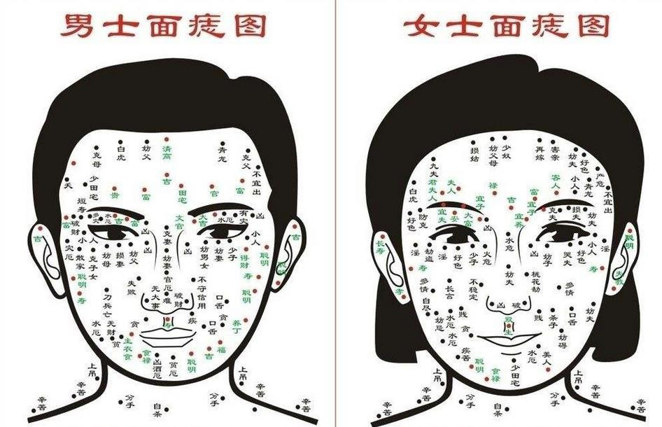 短命痣长在哪里 痣的位置与命运图解